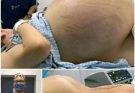 Understanding and Managing Those Painful Red Bumps