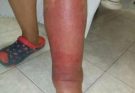 Signs on your FEET that indicate he is cr… see more