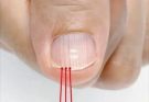 If you have these lines on your nails it’s a clear sign…See more